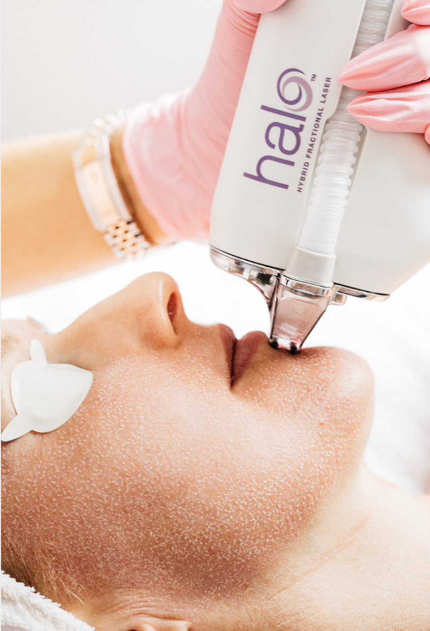 A woman undergoing a laser facial treatment, highlighting her calm demeanor and the advanced technology used in skincare.